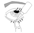 Figure 1 shows where to put the ointment in your eye.