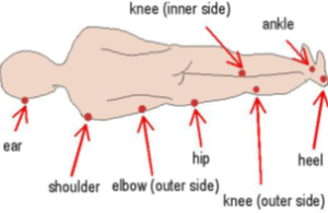 Picture of person laid down with arrows pointing towards various parts of the body