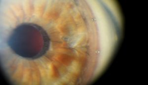 An image of an eye ball 