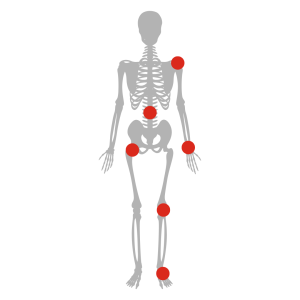 A grey outline of a human skeleton with red circles on various parts of it representing the pain points that can occur. These are Shoulder, Spine, Hand, Hip & Knee and Foot & Ankle. See text to read about each one.