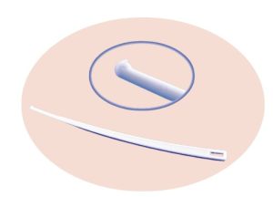 An image of the amnihook used to break the sac of waters around baby.